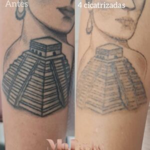 remoÇÃo tatu site popoup