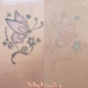 remoÇao tatu site popoup3